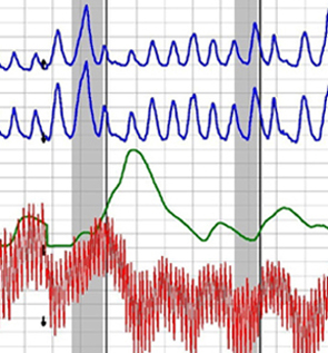 lie detector test chart